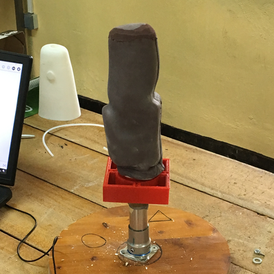 Soft socket being prepared with 3D scanning.  ORTHOLAB | Gatagara, Rwanda.