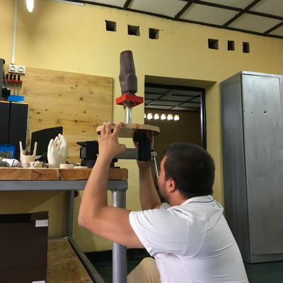 Kyle Reeser holding a soft socket in place for 3D scanning.  ORTHOLAB | Gatagara, Rwanda.  