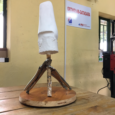 Plaster cast of residual limb being prepared with 3D scanning.  ORTHOLAB | Gatagara, Rwanda.