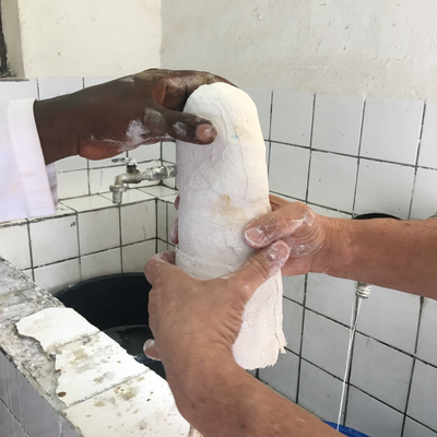 A plaster cast being post-processed by Roberto Postelmans.  HVP-Gatagara | Gatagara, Rwanda.  