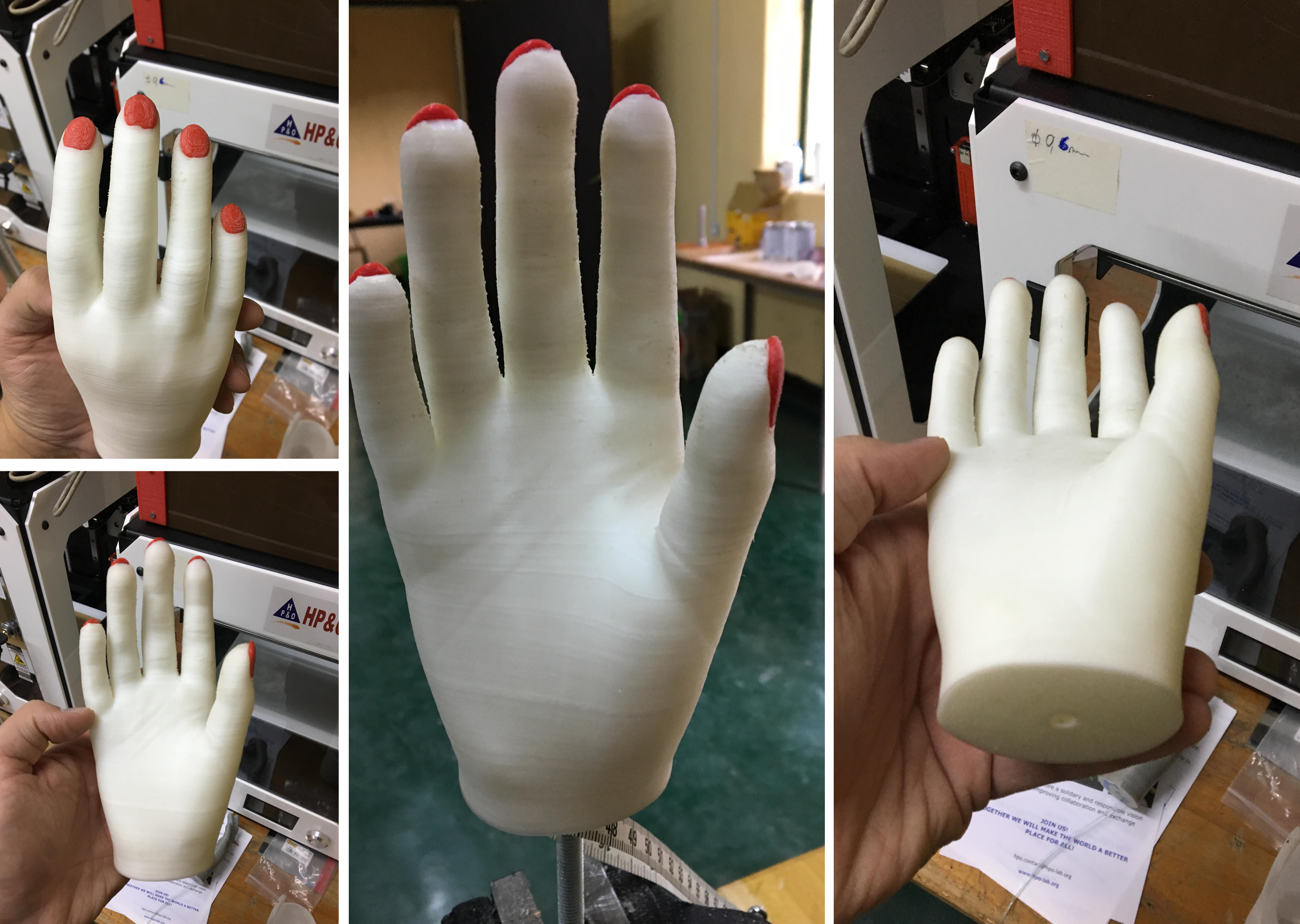 Several views of a 3D printed cosmetic hand with red fingernails.