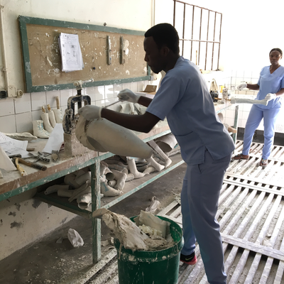 A technician in the P&O department at HVP-Gatagara processing a plaster cast.  HVP-Gatagara | Gatagara, Rwanda.  