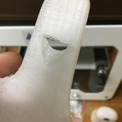 3D printed distal cap, as part of 3-piece prosthetic device designed by Roberto Postelmans.  ORTHOLAB | Gatagara, Rwanda.