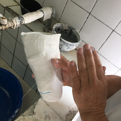 A plaster cast being post-processed by Roberto Postelmans.  HVP-Gatagara | Gatagara, Rwanda.  