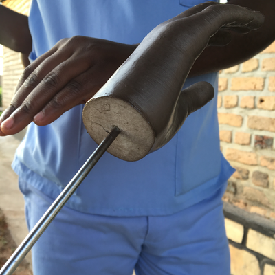 A 3D printed hand (white, Filaflex) sprayed with an Ottobock Superskin coating for cosmetic purposes.  HVP-Gatagara | Gatagara, Rwanda.  