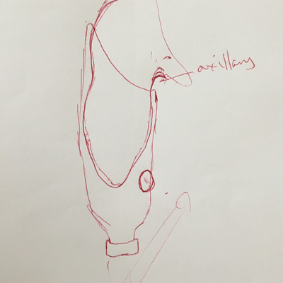 Thermoformed Plastic Bottle Prosthetic Device